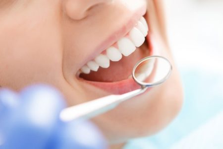 lo-sbiacanamento-dentale-danneggai-i-denti_800x533
